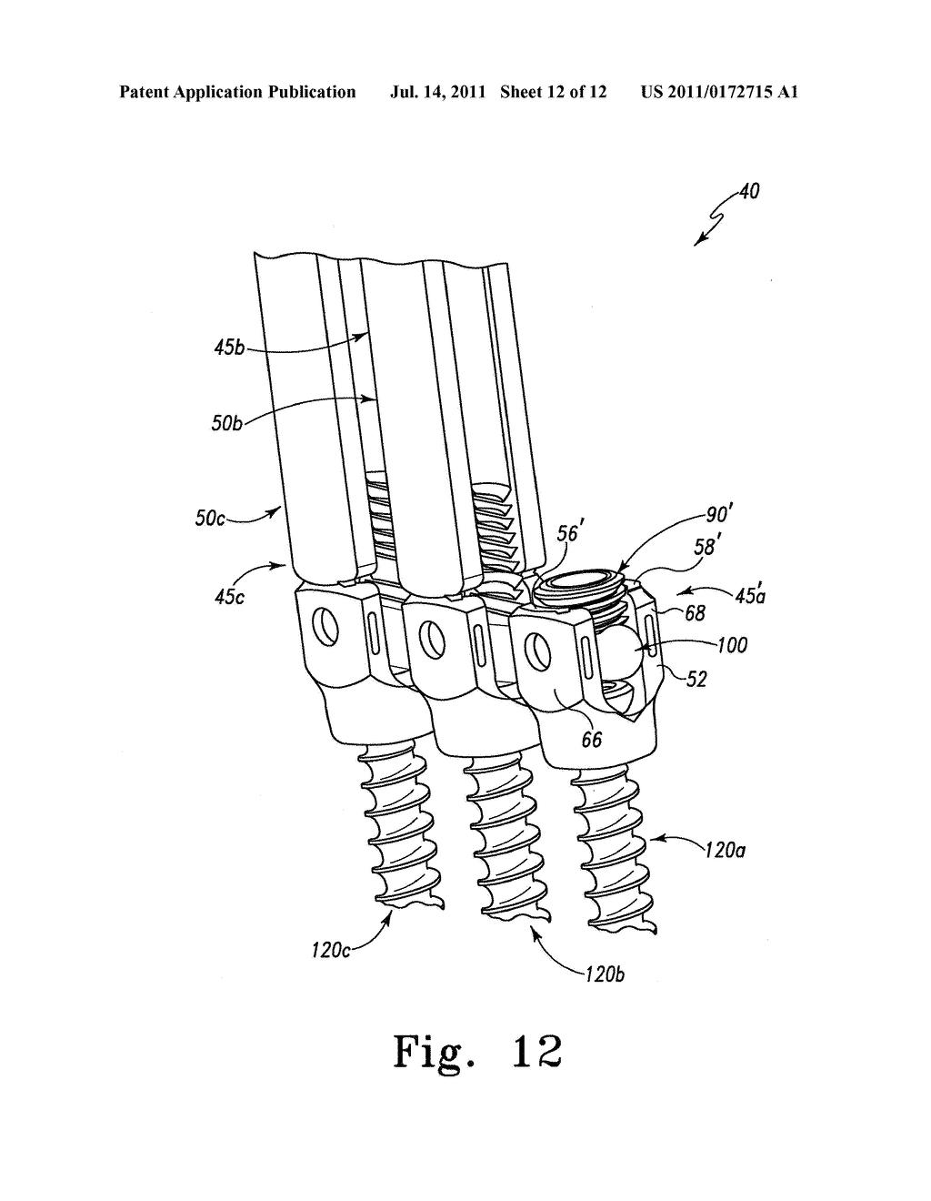 Spinal Anchor Assemblies Having Extended Receivers - diagram, schematic, and image 13