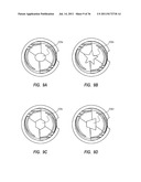 RADIOLUCENT SCREW WITH RADIOPAQUE MARKER diagram and image