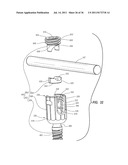 RADIOLUCENT SCREW WITH RADIOPAQUE MARKER diagram and image