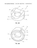 RADIOLUCENT SCREW WITH RADIOPAQUE MARKER diagram and image