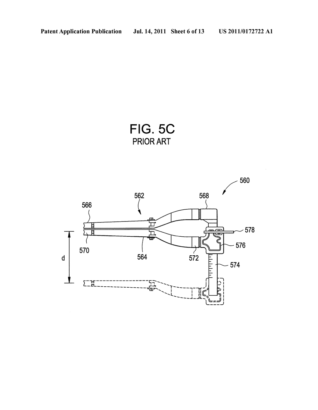 Motion Segment Repair Systems and Methods - diagram, schematic, and image 07