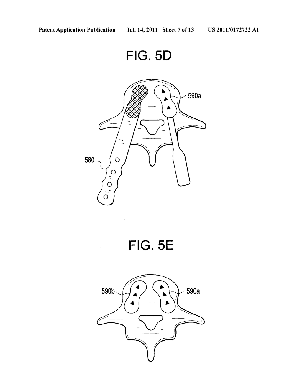 Motion Segment Repair Systems and Methods - diagram, schematic, and image 08