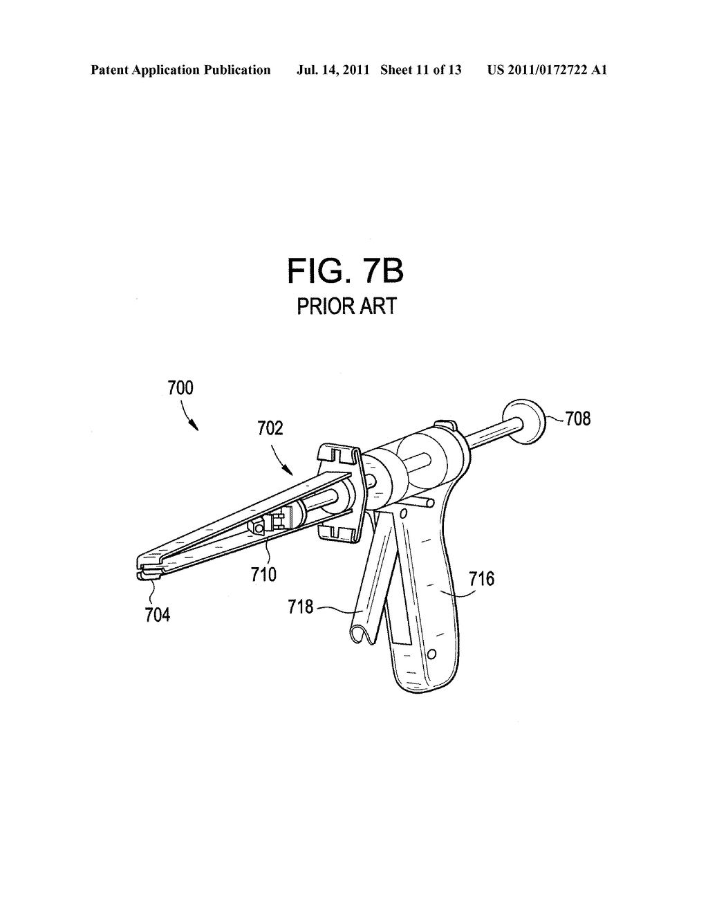 Motion Segment Repair Systems and Methods - diagram, schematic, and image 12