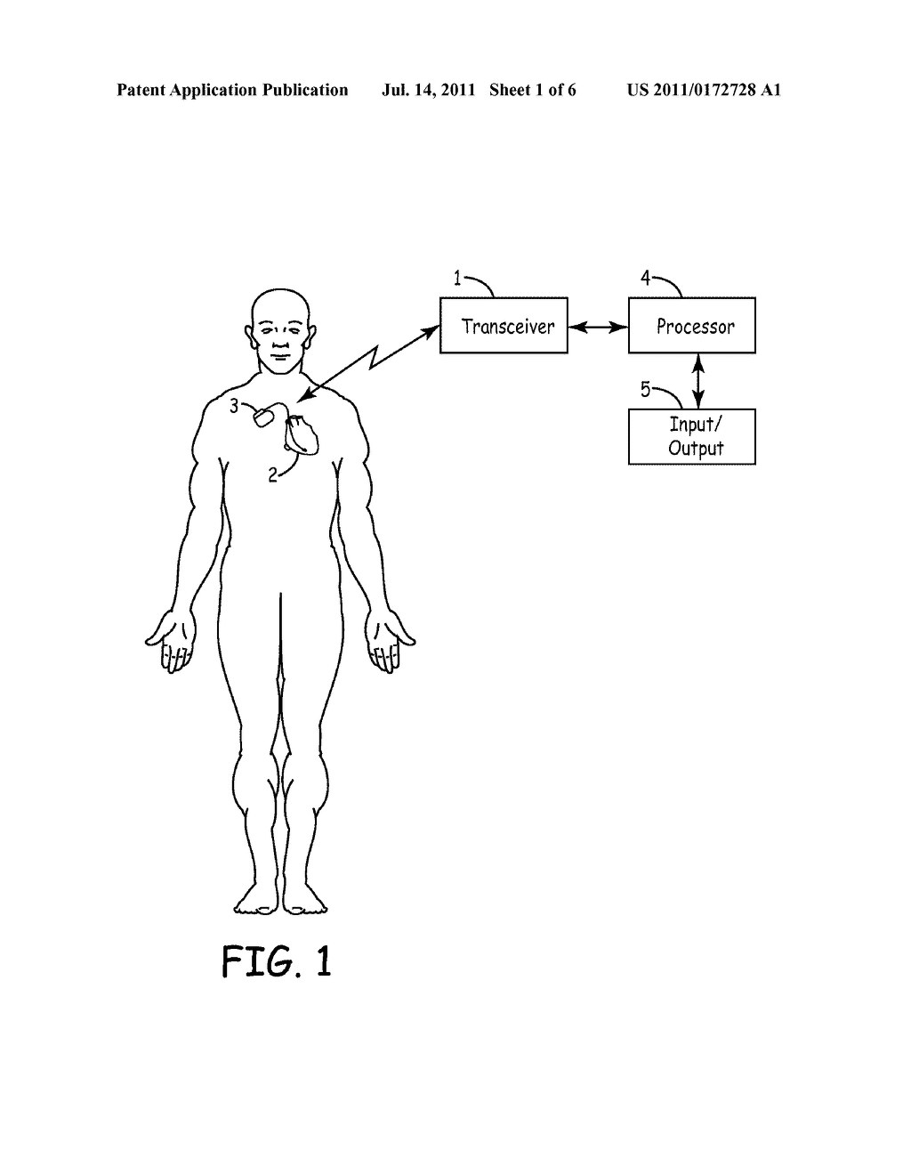 CLOSED LOOP OPTIMIZATION OF A-V AND V-V TIMING - diagram, schematic, and image 02