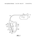 IMPLANTABLE MEDICAL DEVICE WITH EMBEDDED PROGRAMMABLE NON-VOLATILE MEMORY diagram and image