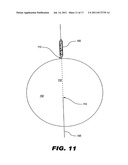 IMPLANTABLE STIMULATOR diagram and image