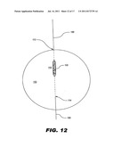 IMPLANTABLE STIMULATOR diagram and image