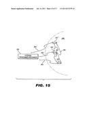 IMPLANTABLE STIMULATOR diagram and image