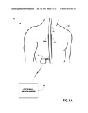 DISPLAY OF DETECTED PATIENT POSTURE STATE diagram and image