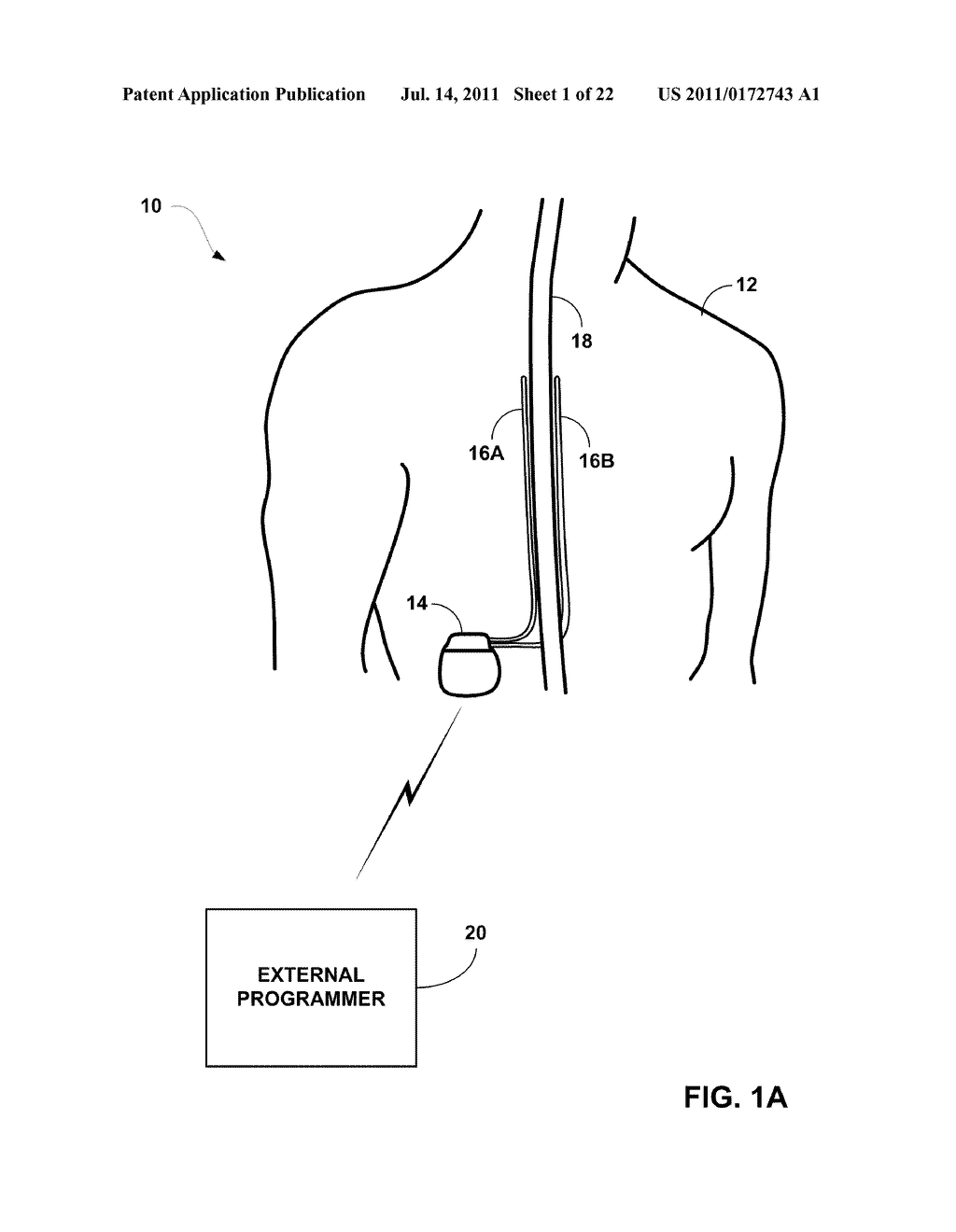 DISPLAY OF DETECTED PATIENT POSTURE STATE - diagram, schematic, and image 02