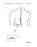 DISPLAY OF DETECTED PATIENT POSTURE STATE diagram and image