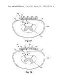 SYSTEMS AND METHODS FOR MAKING AND USING BENDABLE PADDLES WITH IMPLANTABLE     ELECTRICAL STIMULATION SYSTEMS diagram and image