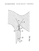 DELIVERY DEVICES AND METHODS FOR HEART VALVE REPAIR diagram and image