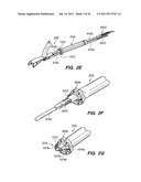 MINIMALLY INVASIVE, DIRECT DELIVERY METHODS FOR IMPLANTING OBESITY     TREATMENT DEVICES diagram and image