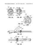 MINIMALLY INVASIVE, DIRECT DELIVERY METHODS FOR IMPLANTING OBESITY     TREATMENT DEVICES diagram and image