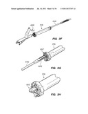 MINIMALLY INVASIVE, DIRECT DELIVERY METHODS FOR IMPLANTING OBESITY     TREATMENT DEVICES diagram and image