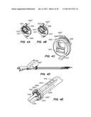 MINIMALLY INVASIVE, DIRECT DELIVERY METHODS FOR IMPLANTING OBESITY     TREATMENT DEVICES diagram and image