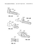 MINIMALLY INVASIVE, DIRECT DELIVERY METHODS FOR IMPLANTING OBESITY     TREATMENT DEVICES diagram and image