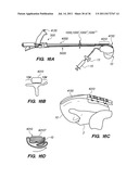 MINIMALLY INVASIVE, DIRECT DELIVERY METHODS FOR IMPLANTING OBESITY     TREATMENT DEVICES diagram and image