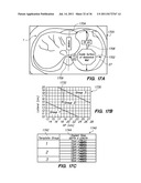 MINIMALLY INVASIVE, DIRECT DELIVERY METHODS FOR IMPLANTING OBESITY     TREATMENT DEVICES diagram and image