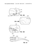 MINIMALLY INVASIVE, DIRECT DELIVERY METHODS FOR IMPLANTING OBESITY     TREATMENT DEVICES diagram and image