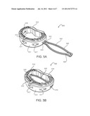 INTERBODY IMPLANT WITH GRAFT RETAINING BONE CAP diagram and image