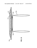 Implantable Repair Device diagram and image