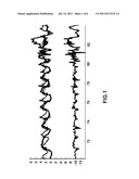 Method and device for detecting the On and Off states of a Parkinson     patient diagram and image