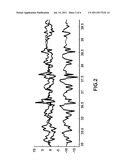 Method and device for detecting the On and Off states of a Parkinson     patient diagram and image