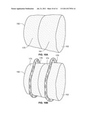 Disk-Shaped Gas Production Filter Elements diagram and image