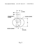 PROGRESSIVE CAVITY COMPRESSOR diagram and image