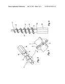 Occlusive Plug diagram and image