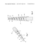 Occlusive Plug diagram and image