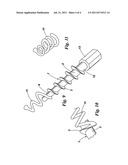 Occlusive Plug diagram and image