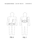 METHOD FOR TREATING OBSTRUCTIVE SLEEP APNEA AND/OR SNORING diagram and image