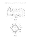 SYSTEM FOR HIGH PRESSURE INJECTION OVERMOLDING diagram and image