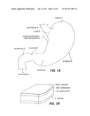 ENDOSCOPIC STAPLING DEVICES AND METHODS diagram and image