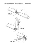 ENDOSCOPIC STAPLING DEVICES AND METHODS diagram and image