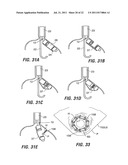 ENDOSCOPIC STAPLING DEVICES AND METHODS diagram and image