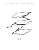 Apparatus and Methods for Monitoring Objects in a Surgical Field diagram and image