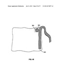 Apparatus and Methods for Monitoring Objects in a Surgical Field diagram and image