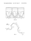 Modular Low Profile Swivel Mechanism diagram and image