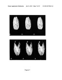 NON-CARTESIAN UNDER-SAMPLED MULTI-ECHO MRI diagram and image