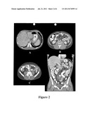 PALATABLE LIQUID DILUTION VEHICLES FOR ORAL CONTRAST AGENTS diagram and image