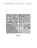 ADULT BONE MARROW CELL TRANSPLANTATION TO TESTES CREATION OF     TRANSDIFFERENTIATED TESTES GERM CELLS, LEYDIG CELLS AND SERTOLI CELLS diagram and image