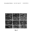 ADULT BONE MARROW CELL TRANSPLANTATION TO TESTES CREATION OF     TRANSDIFFERENTIATED TESTES GERM CELLS, LEYDIG CELLS AND SERTOLI CELLS diagram and image