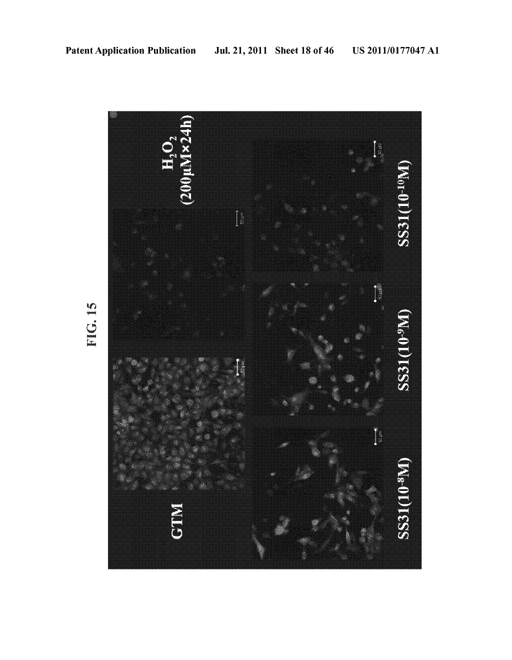 METHODS AND COMPOSITIONS FOR PREVENTING OR TREATING OPHTHALMIC CONDITIONS - diagram, schematic, and image 19