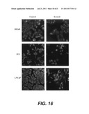 TARGETING PAX2 FOR THE INDUCTION OF DEFB1-MEDIATED TUMOR IMMUNITY AND     CANCER THERAPY diagram and image