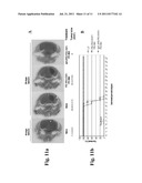 TARGETED DOUBLE STRANDED RNA MEDIATED CELL KILLING diagram and image