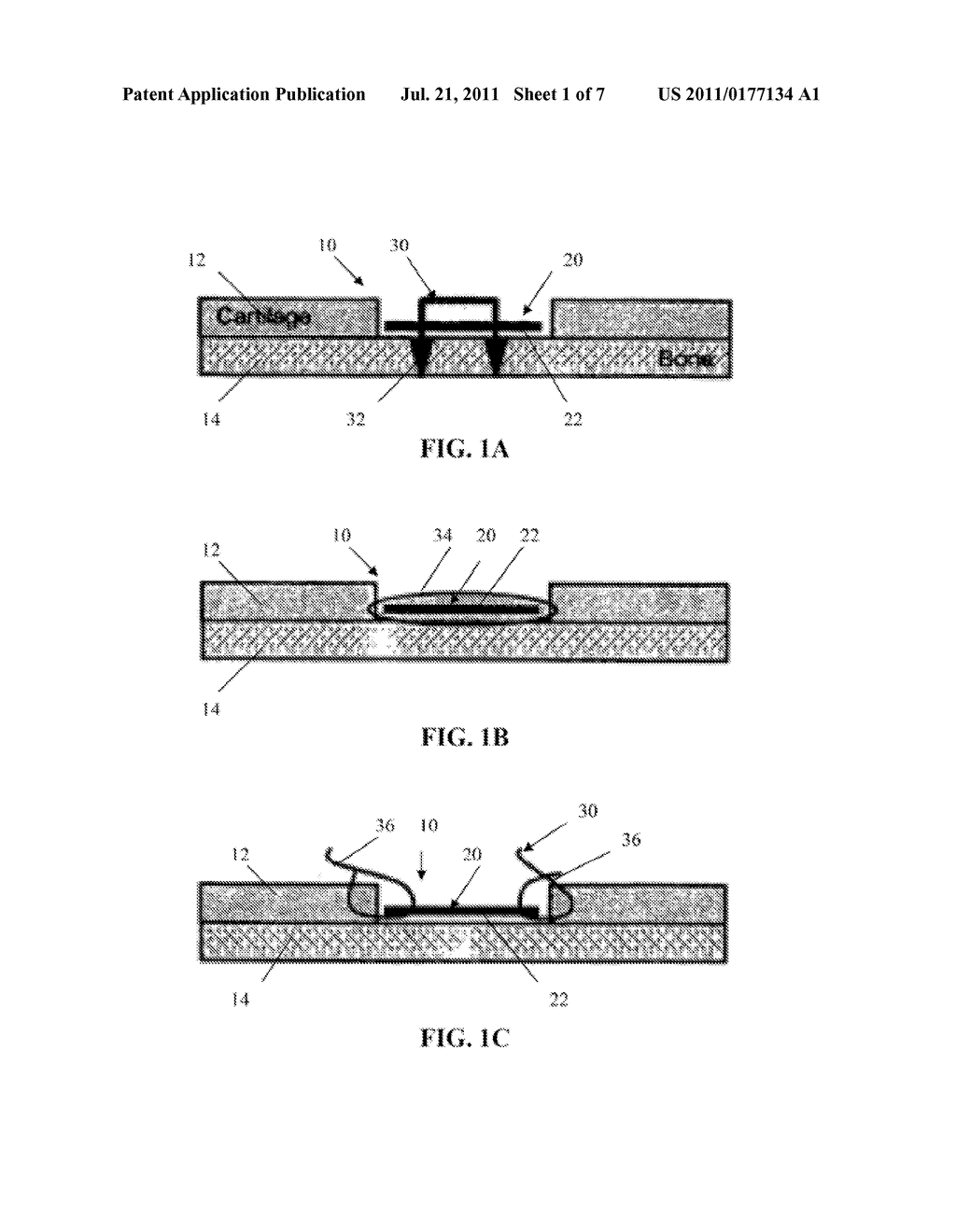 Viable Tissue Repair Implants and Methods of Use - diagram, schematic, and image 02